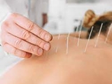 Cấy Chỉ Điều Trị Thoát Vị Đĩa Đệm Đốt Sống Cổ