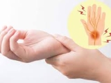 Châm Cứu Điều Trị Tê Lòng Bàn Tay